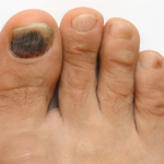 Mycosyn-Pro-Ingredients