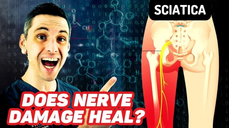 Sciatica Recovery System Review 2026: Back Pain Program Guide